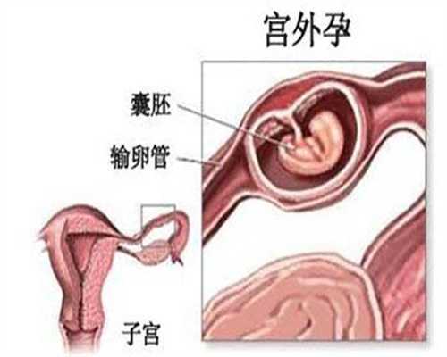 宁波第三人民医院供卵试管婴儿助孕：宁波第三人民医院供卵试管婴儿助孕费用